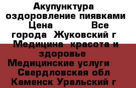 Акупунктура, оздоровление пиявками › Цена ­ 3 000 - Все города, Жуковский г. Медицина, красота и здоровье » Медицинские услуги   . Свердловская обл.,Каменск-Уральский г.